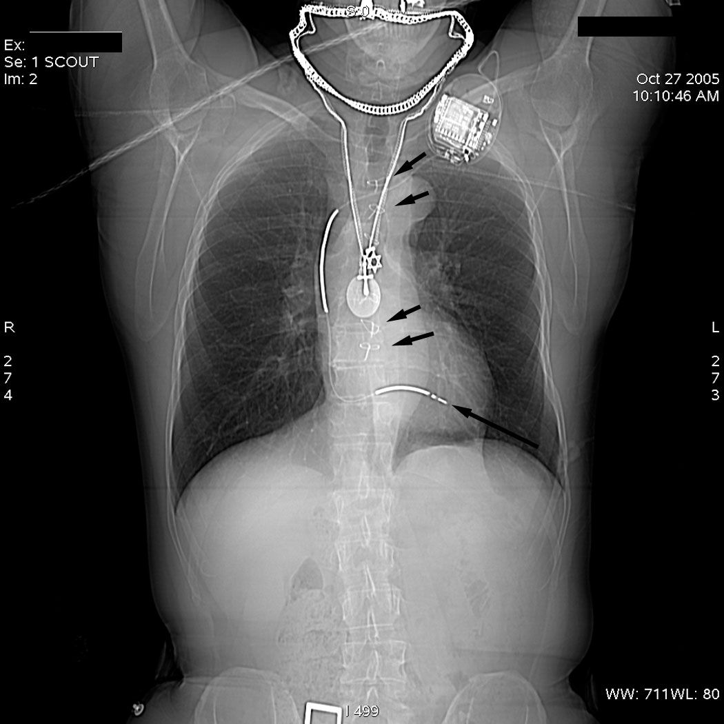 MasterMedFacts | Chest X-Ray